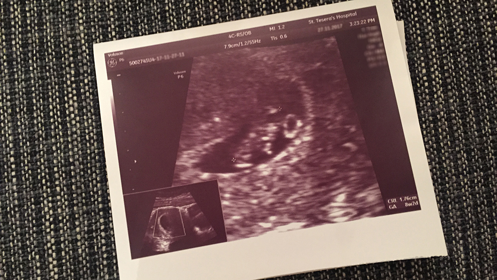 ultrasound.jpg.jpg